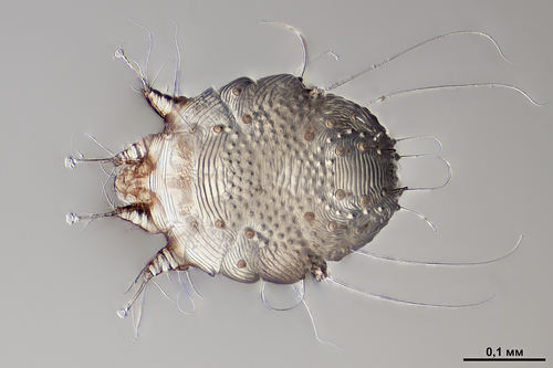vue microscopique du sarcoptes-scabiei